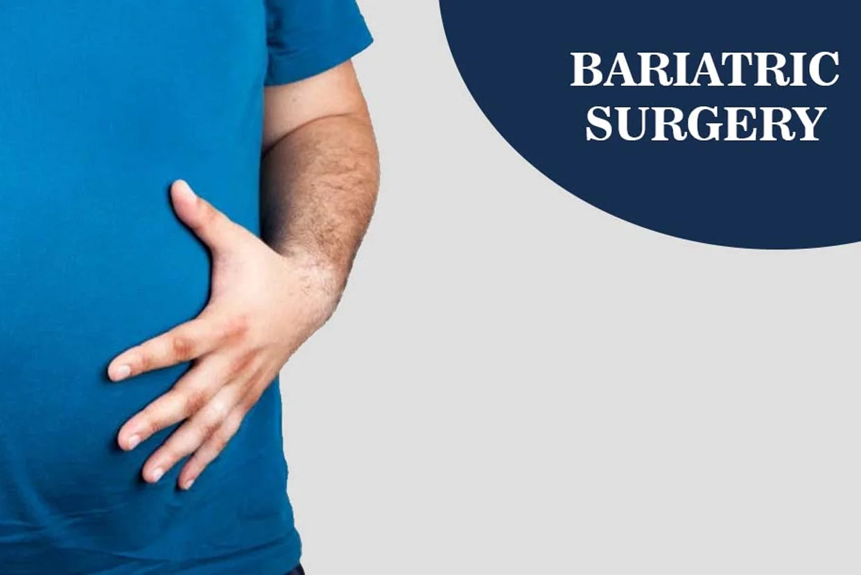 Bariatric (Obesity) Surgery